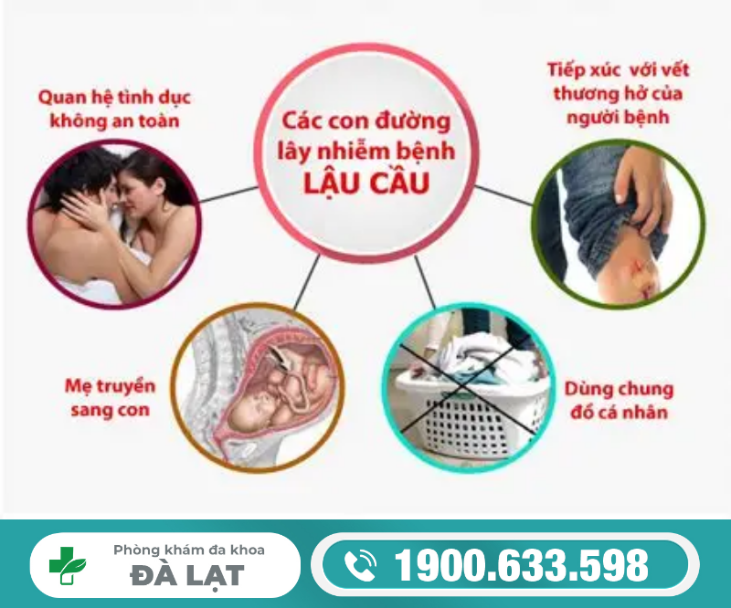 Hình ảnh minh họa